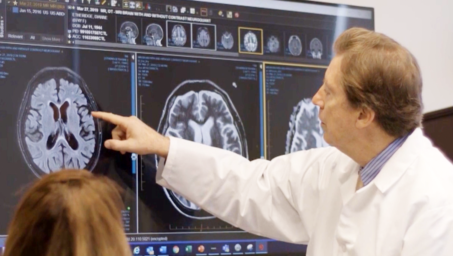 Doctor pointing at brain scan